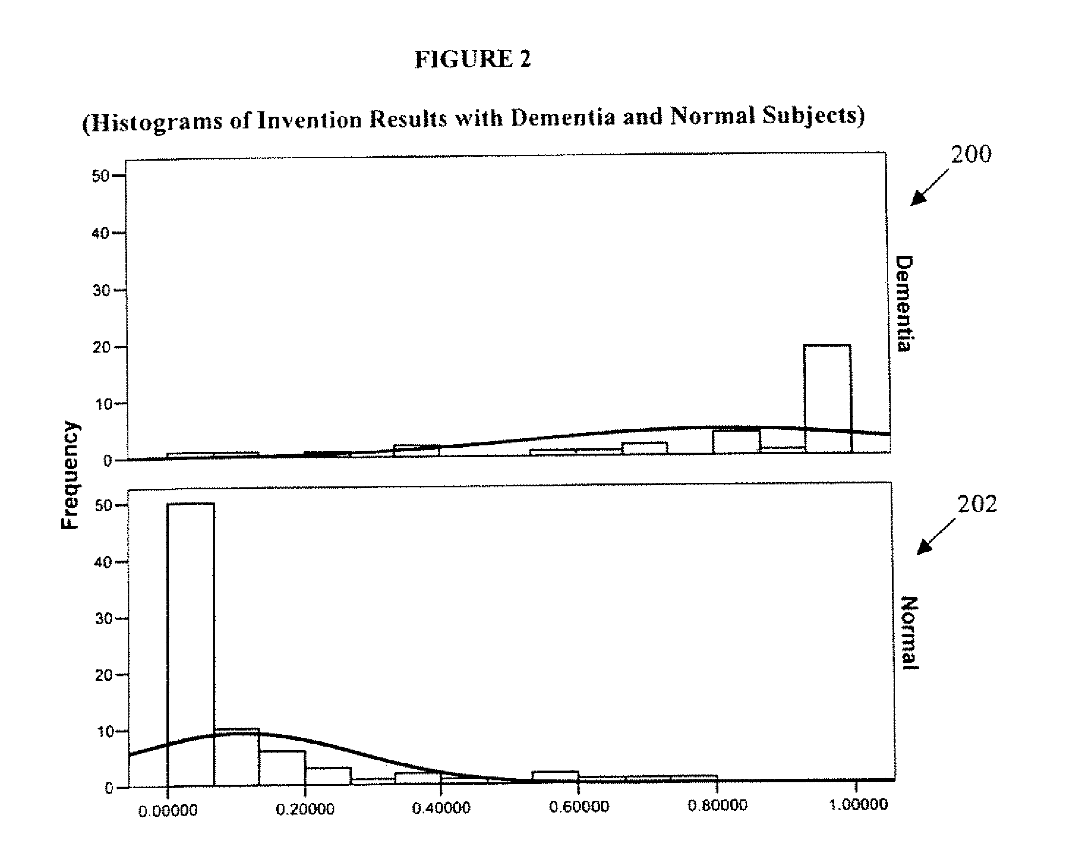 Systems and Methods for Analyzing and Assessing Dementia and Dementia-Type Disorders