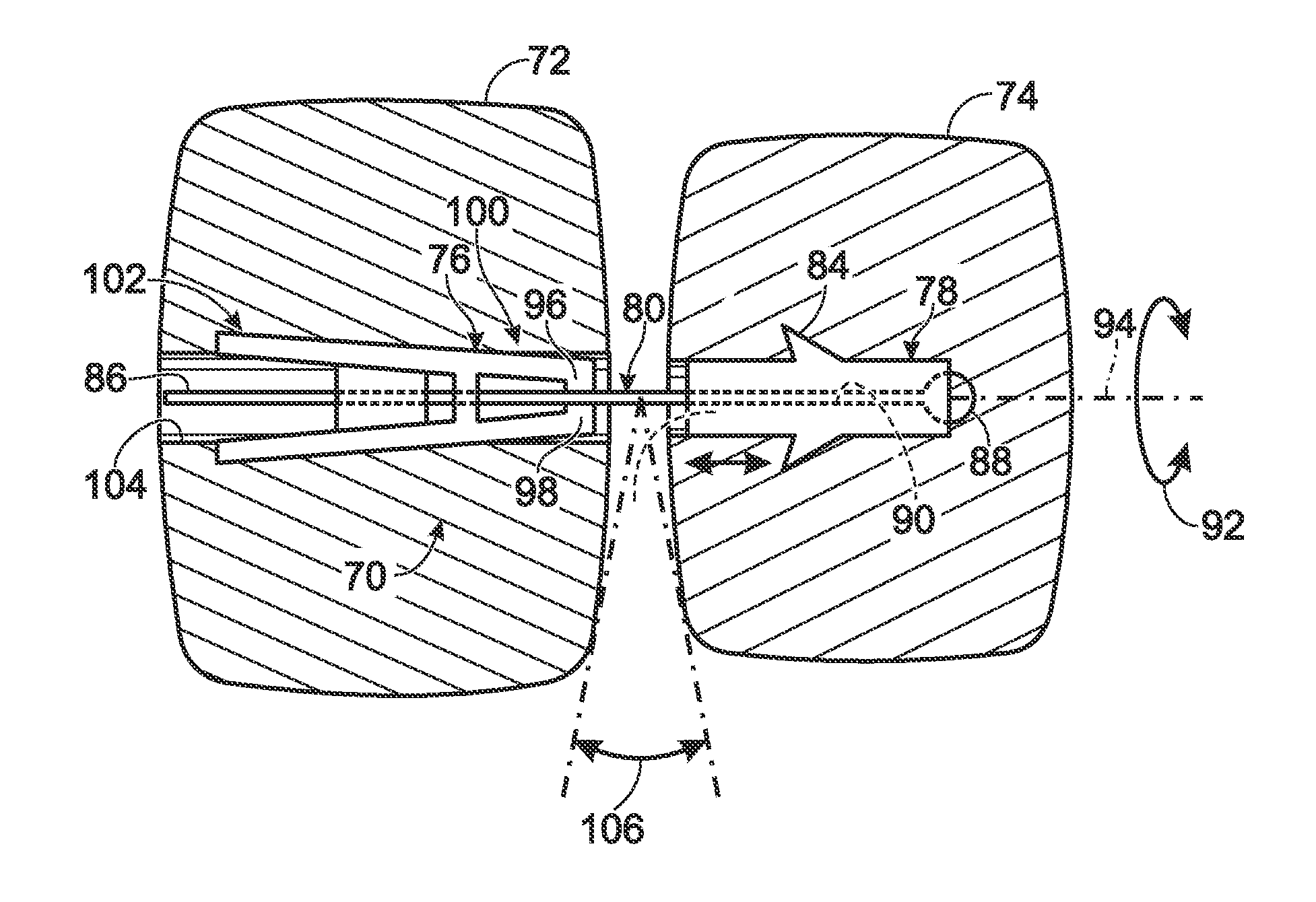 Orthopedic connector system