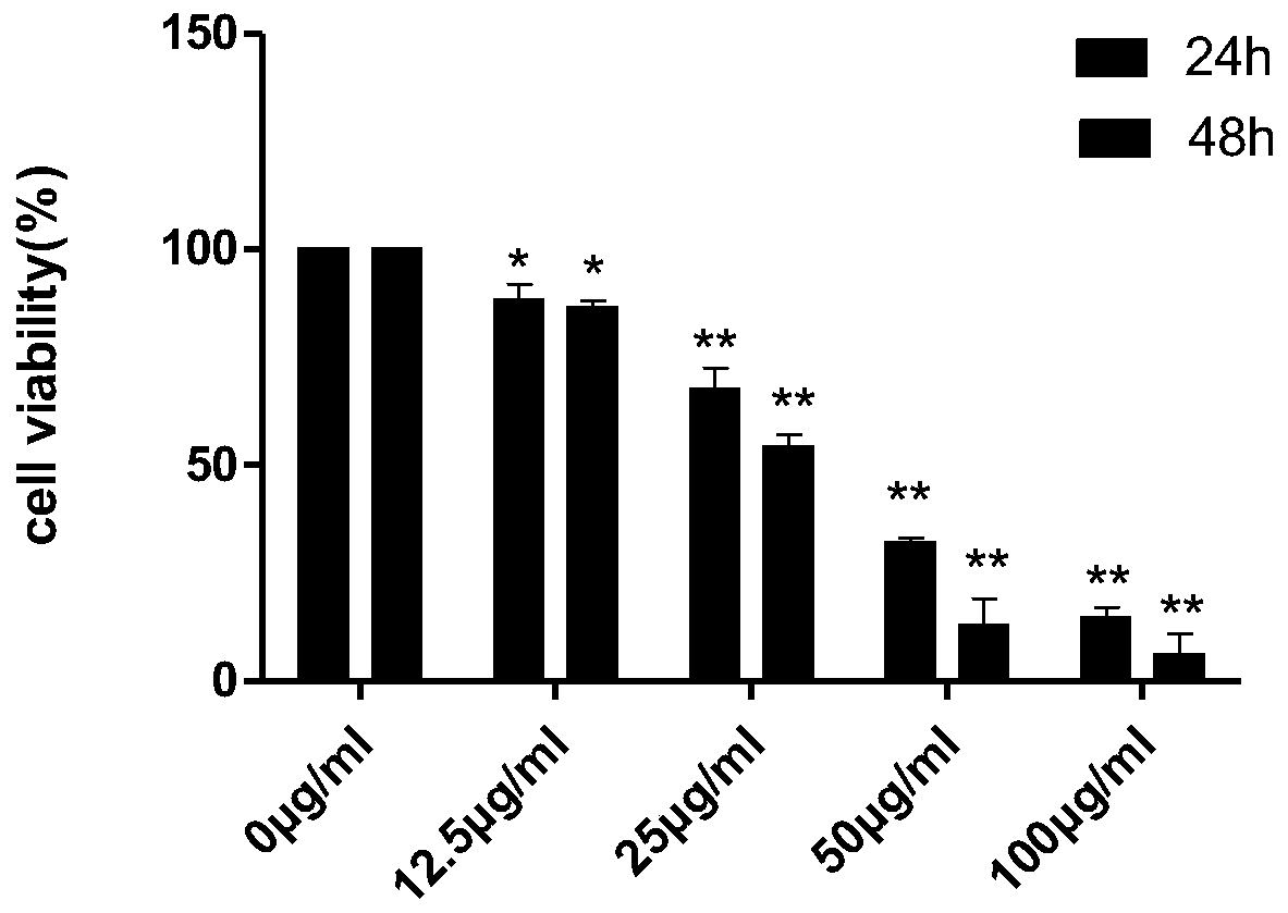 Application of lappaconitine or 12-epi-lappaconitine in preparation of medicine for treating leukemia