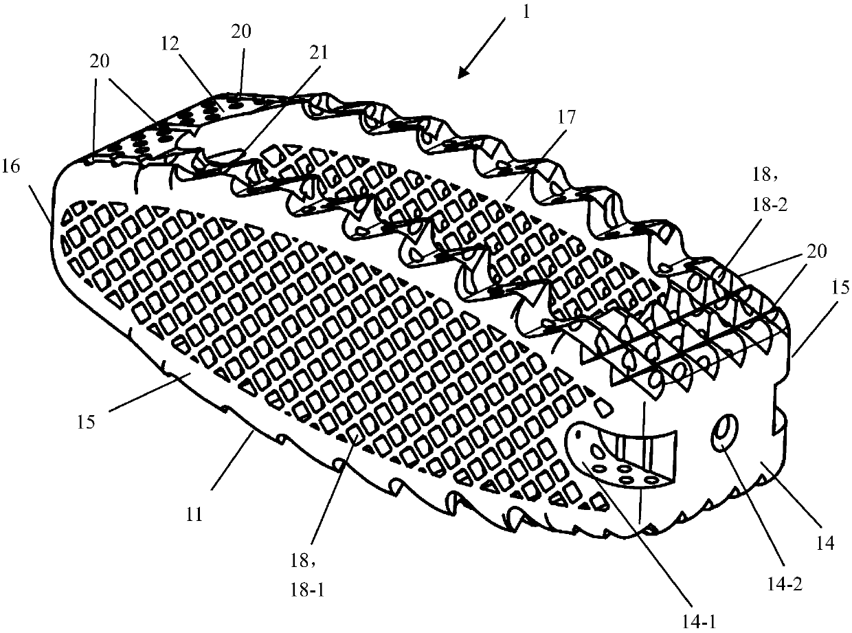 Thoracolumbarinterbody fusion cage