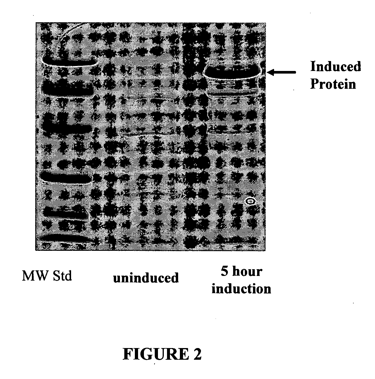 Antimicrobial Activity in Variants of Lacritin