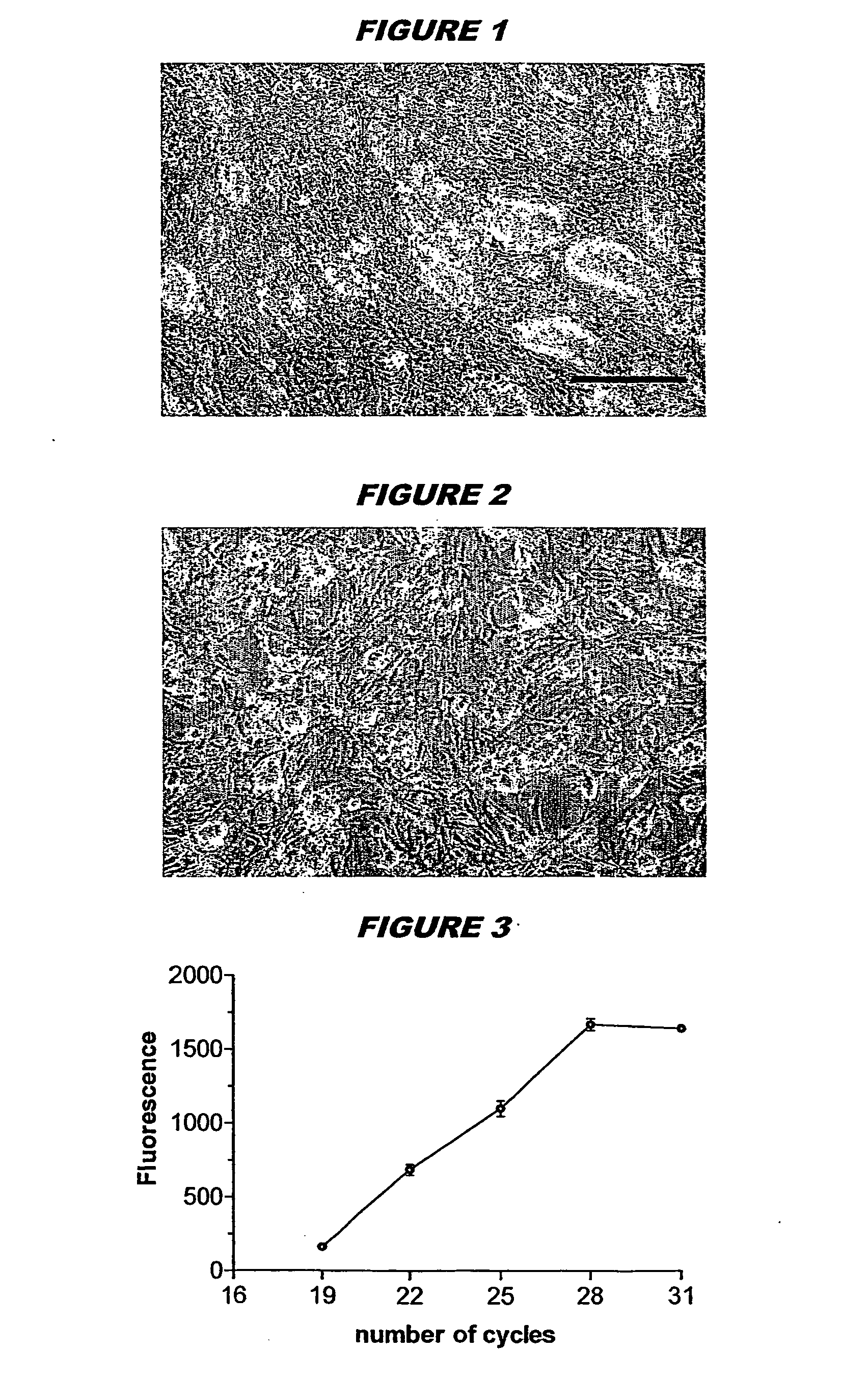 Preparation of type II pneumocytes from stem cells