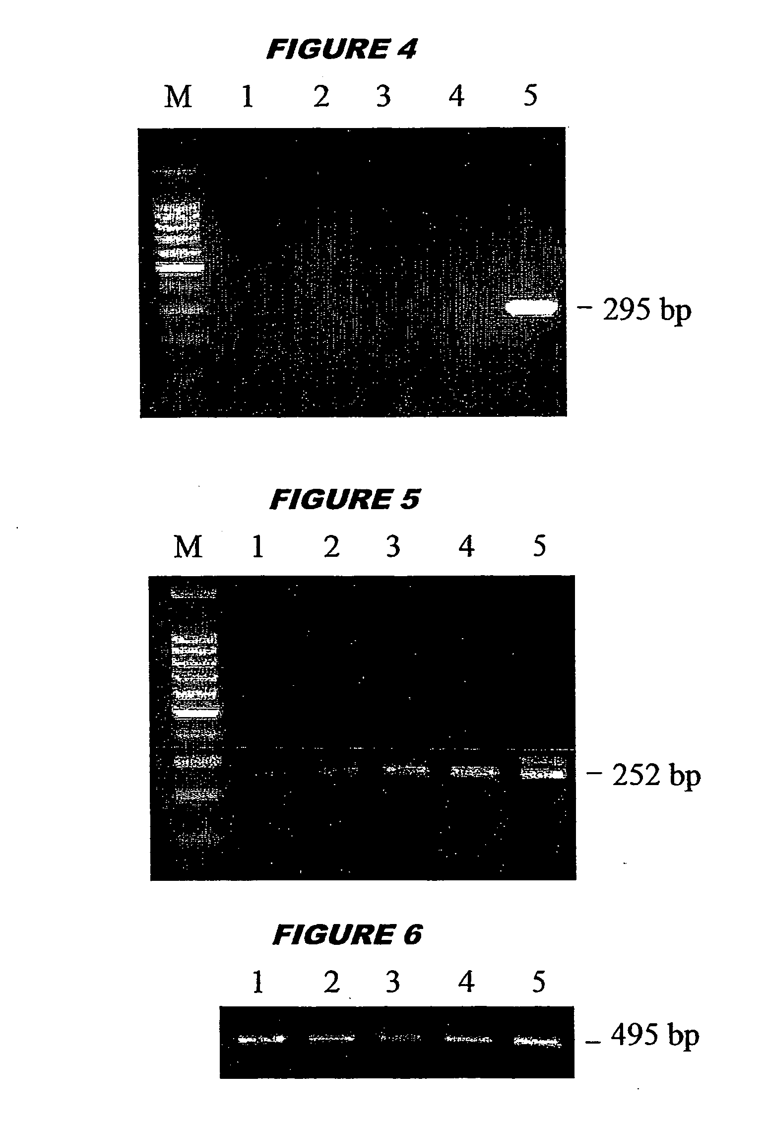 Preparation of type II pneumocytes from stem cells