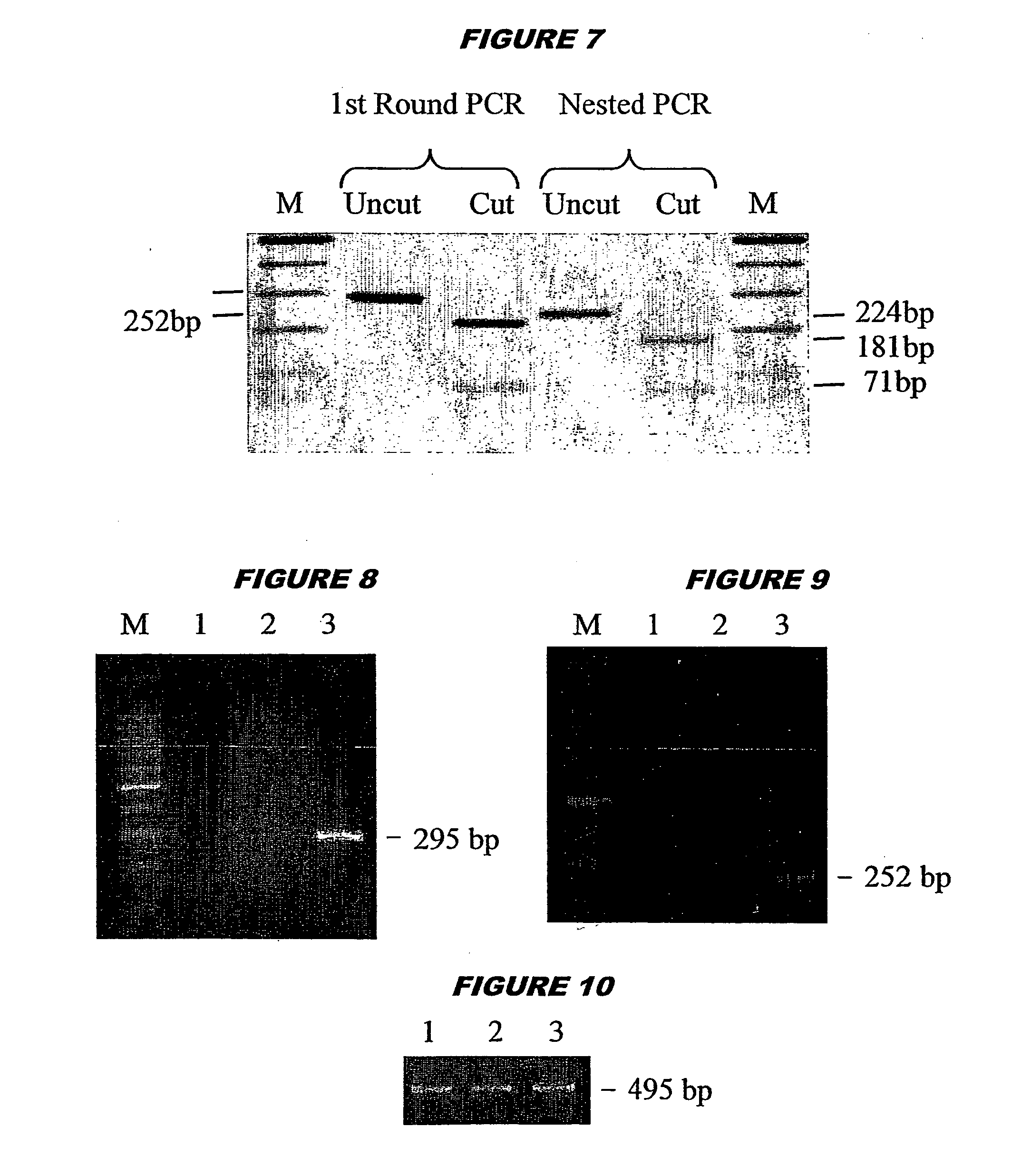 Preparation of type II pneumocytes from stem cells