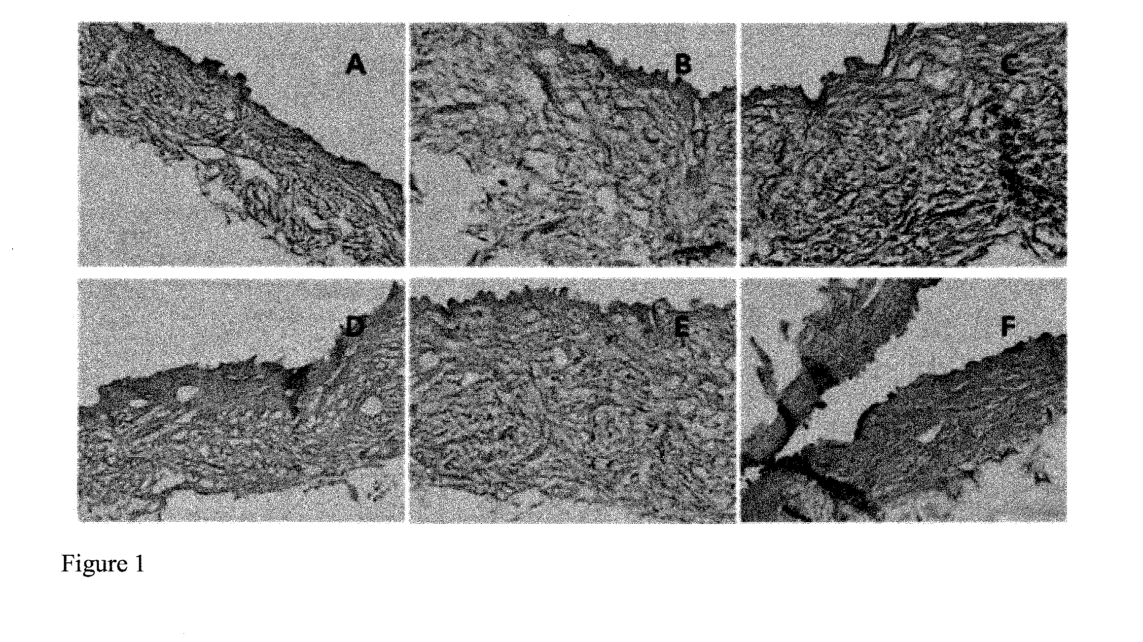 Method For Producing An Acellular Dermal Matrix, And Acellular Dermal Matrix Produced By Same