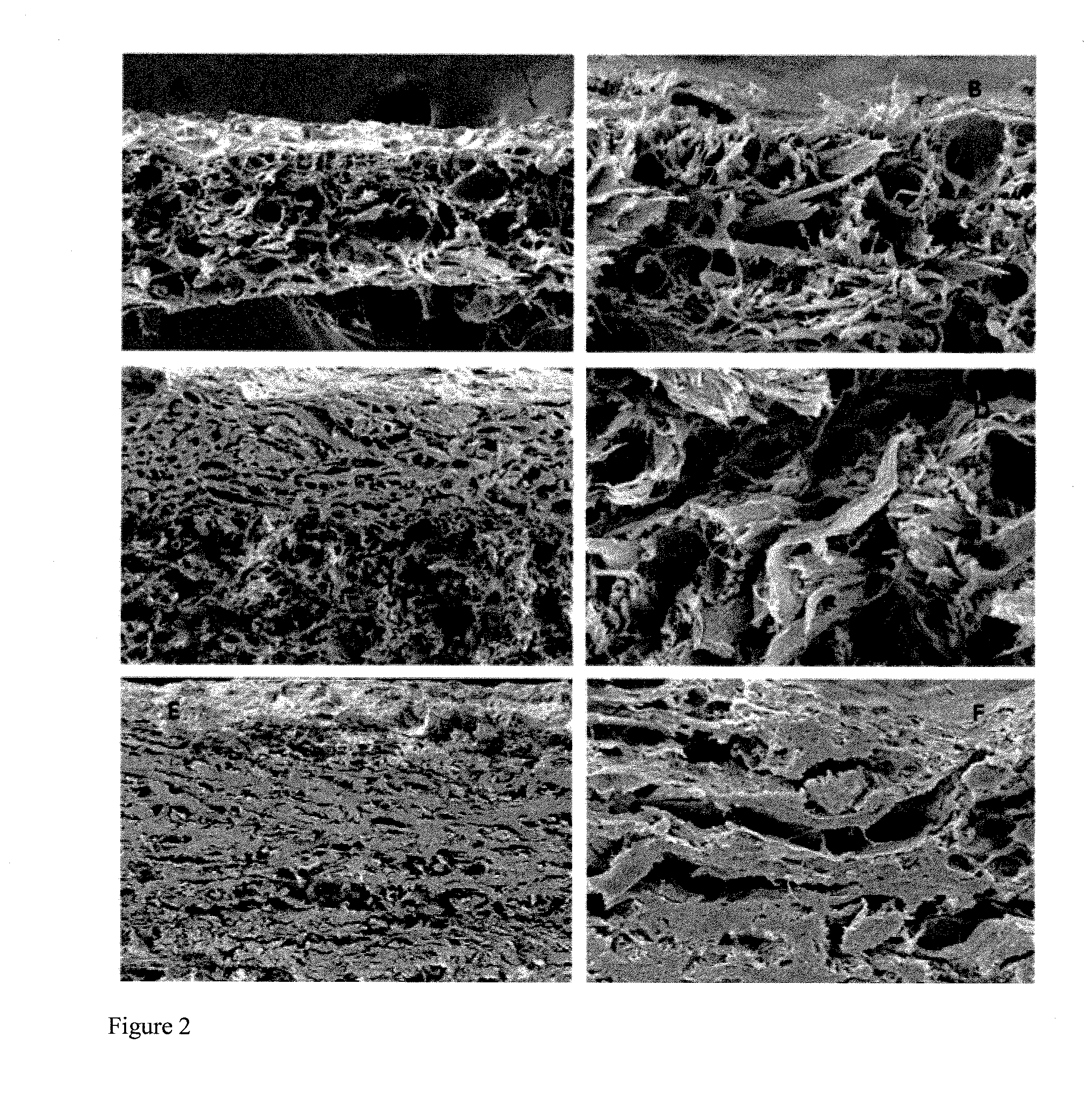 Method For Producing An Acellular Dermal Matrix, And Acellular Dermal Matrix Produced By Same