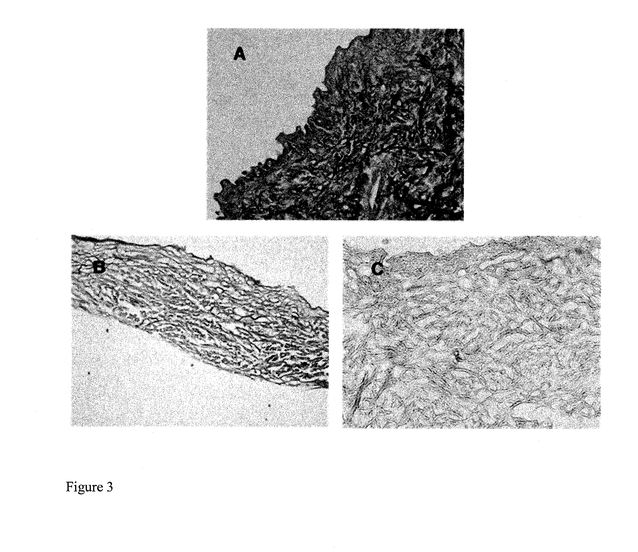 Method For Producing An Acellular Dermal Matrix, And Acellular Dermal Matrix Produced By Same