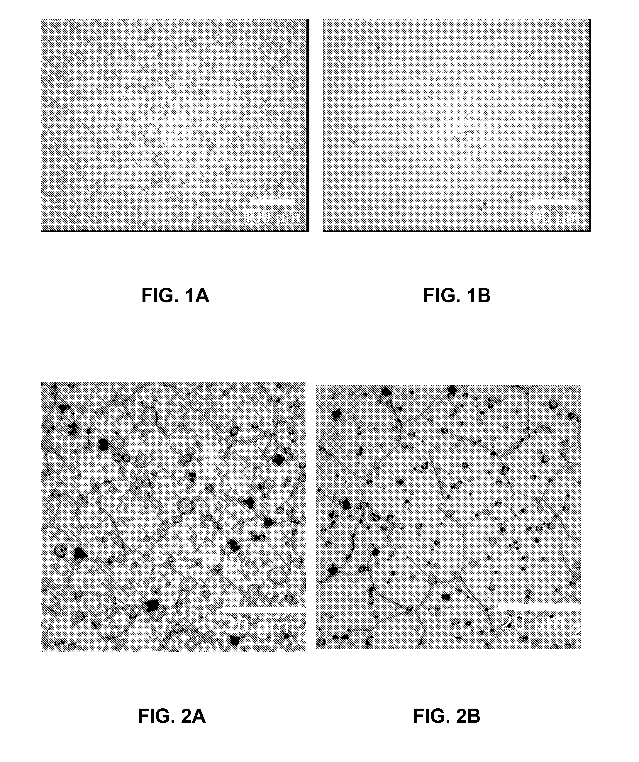 Implant Made of a Biodegradable Magnesium Alloy