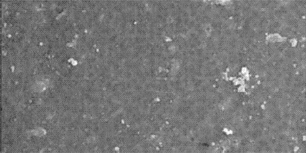 A bioenzyme sensor implantable in human body and its manufacturing method