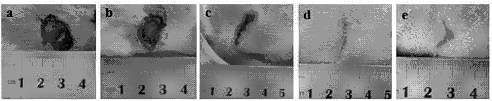 Method for preparing skin regeneration material loaded with bioactive glass particles