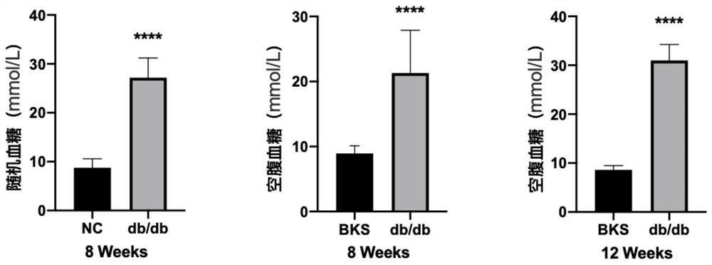 Application of remdesivir in the preparation of drugs for the treatment of diabetic complications