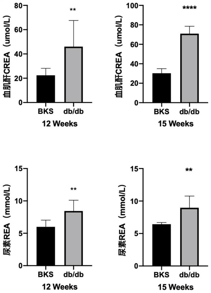 Application of remdesivir in the preparation of drugs for the treatment of diabetic complications