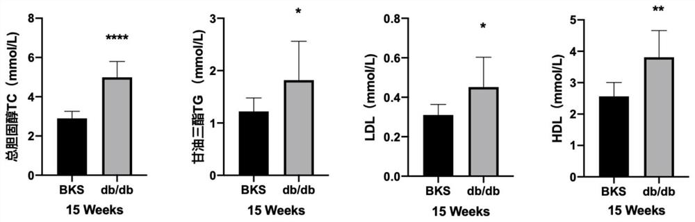 Application of remdesivir in the preparation of drugs for the treatment of diabetic complications