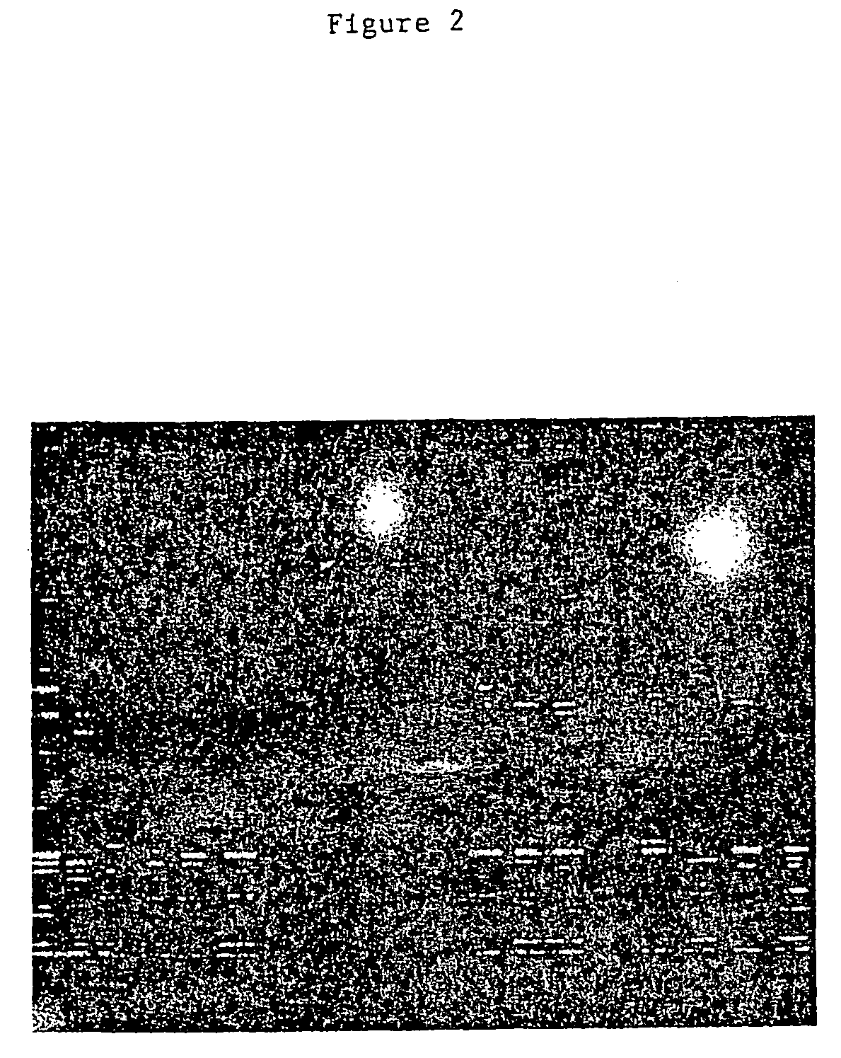 Methods of cardiovascular disease assessment in an individual