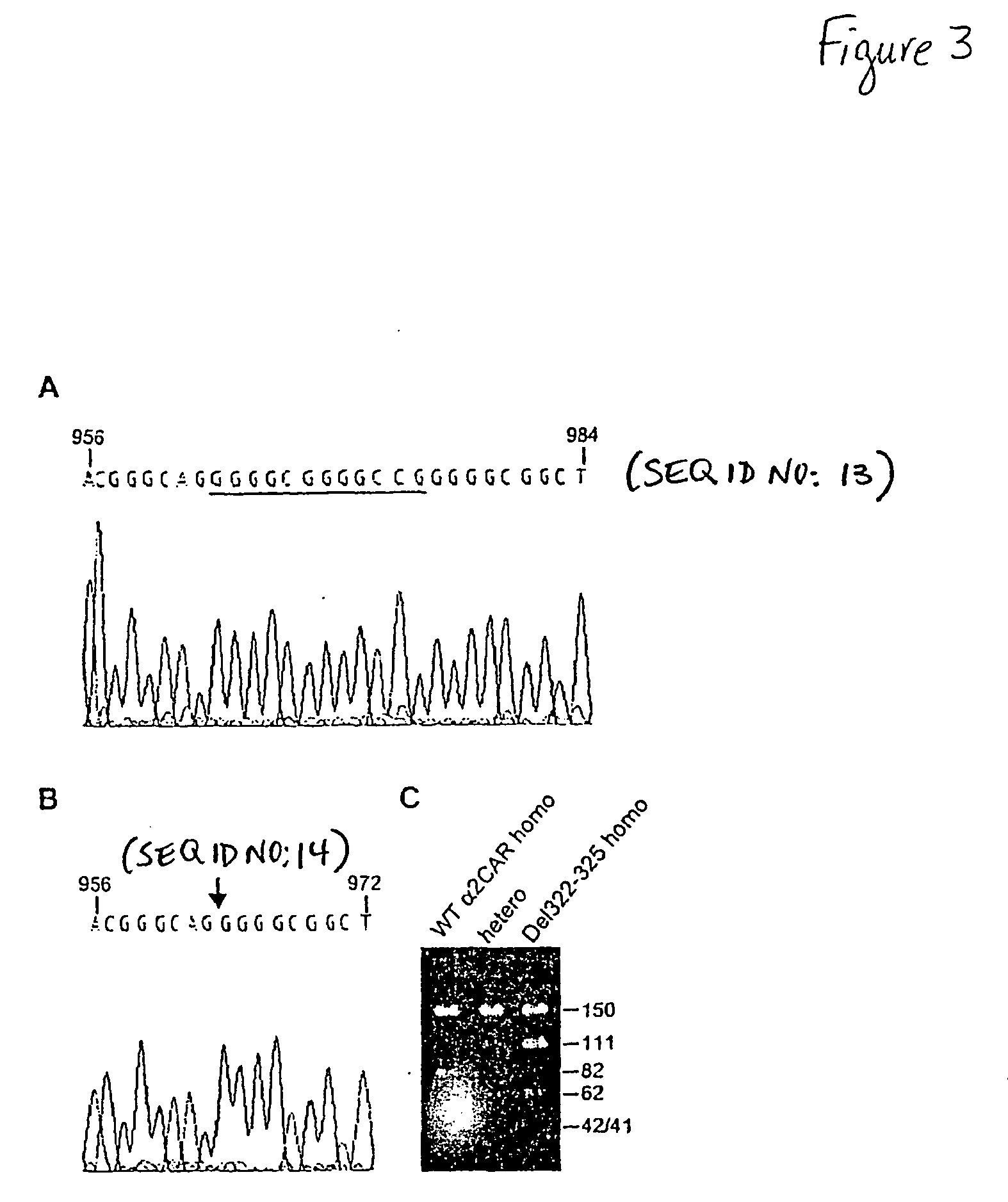 Methods of cardiovascular disease assessment in an individual