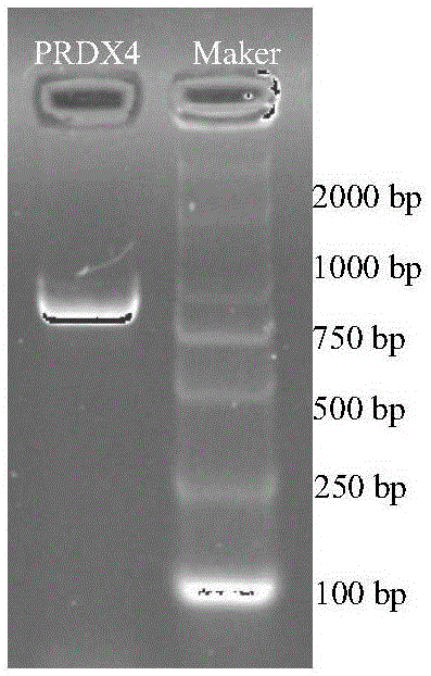 Cervus nippon PRDX4 gene, cloning method thereof and encoding protein