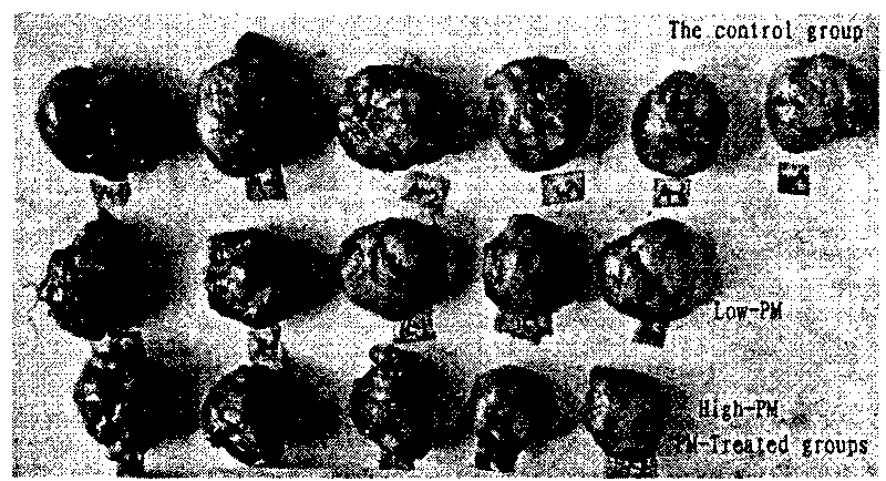 Medicinal preparation with inhibiting effect on tumor metastasis