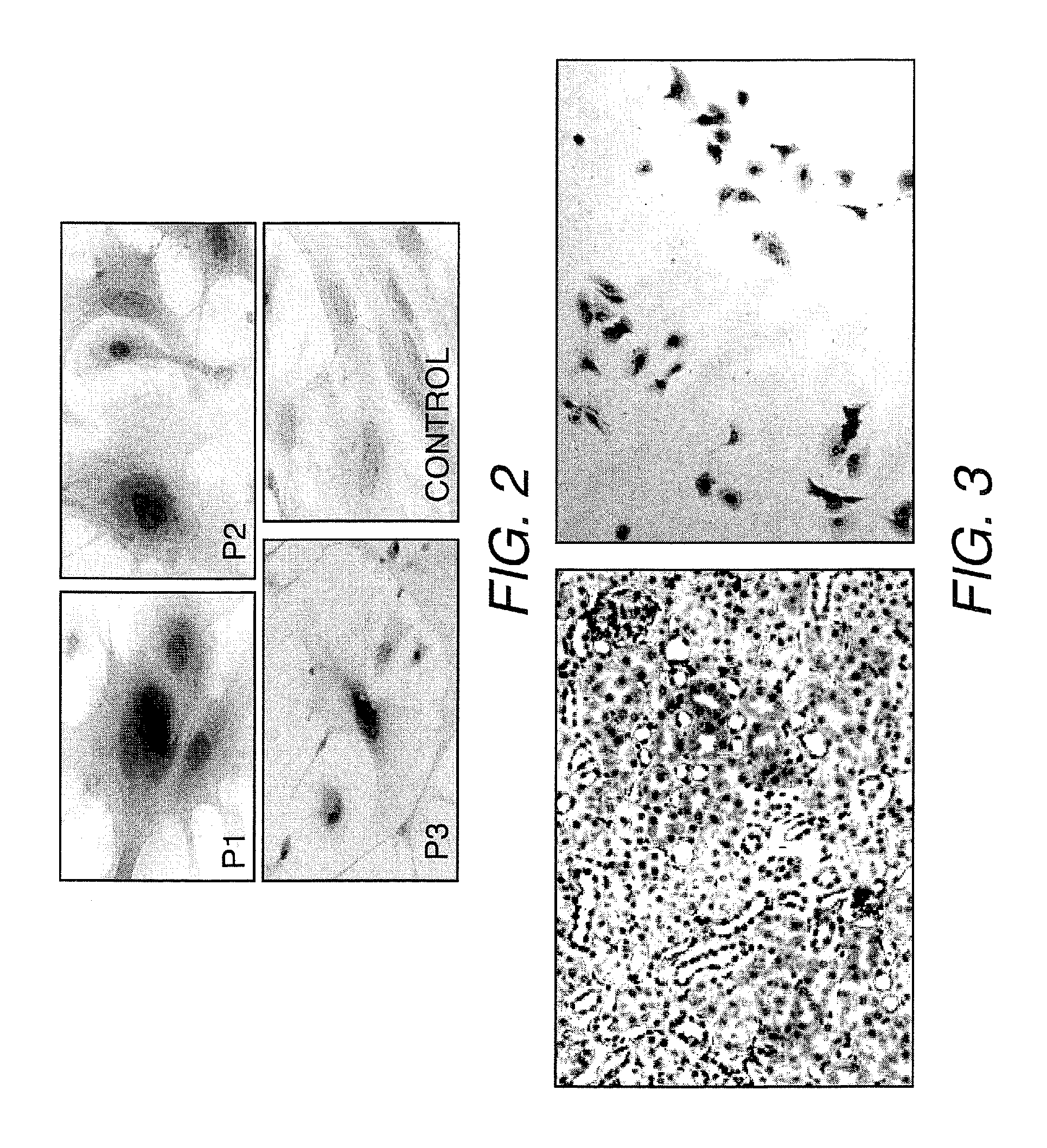 Kidney structures and methods of forming the same