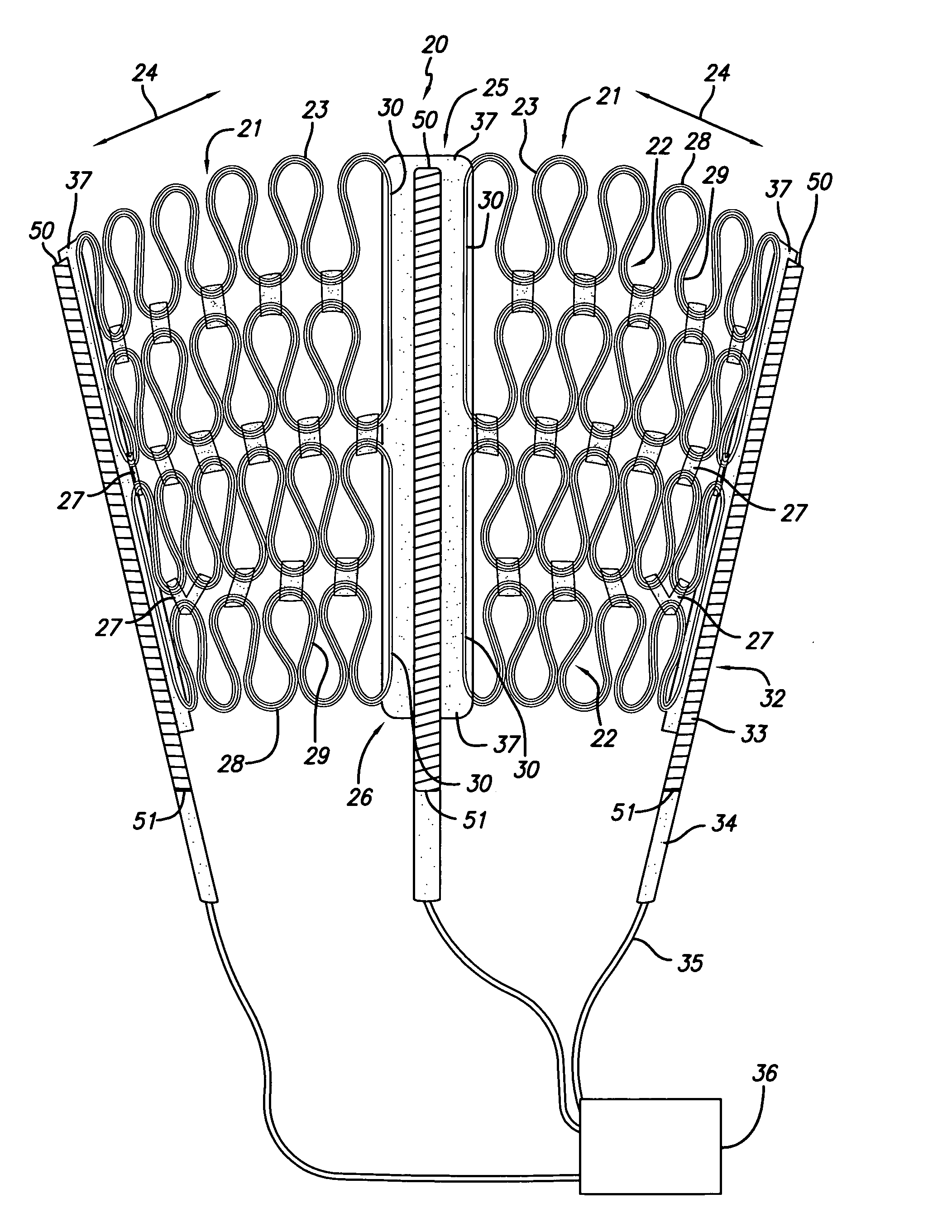 Cardiac harness for treating heart disease