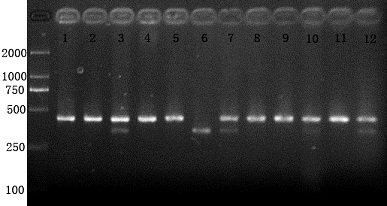 A simple and rapid DNA extraction method from chicken whole blood