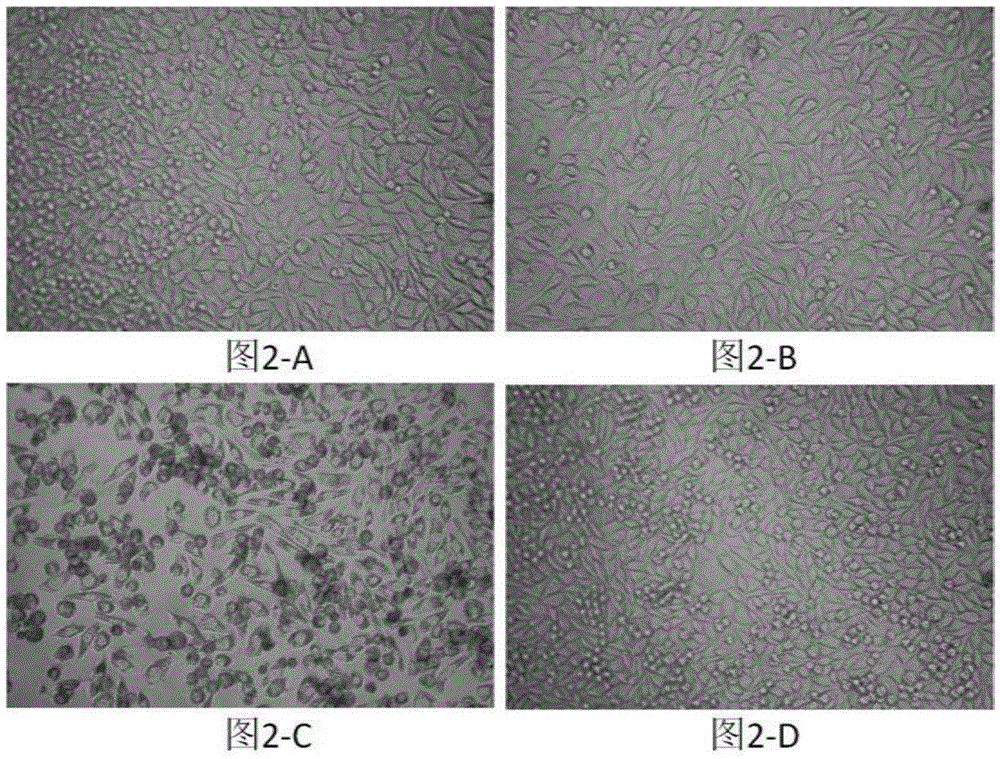 A kind of injectable cross-linked hyaluronic acid gel and preparation method thereof