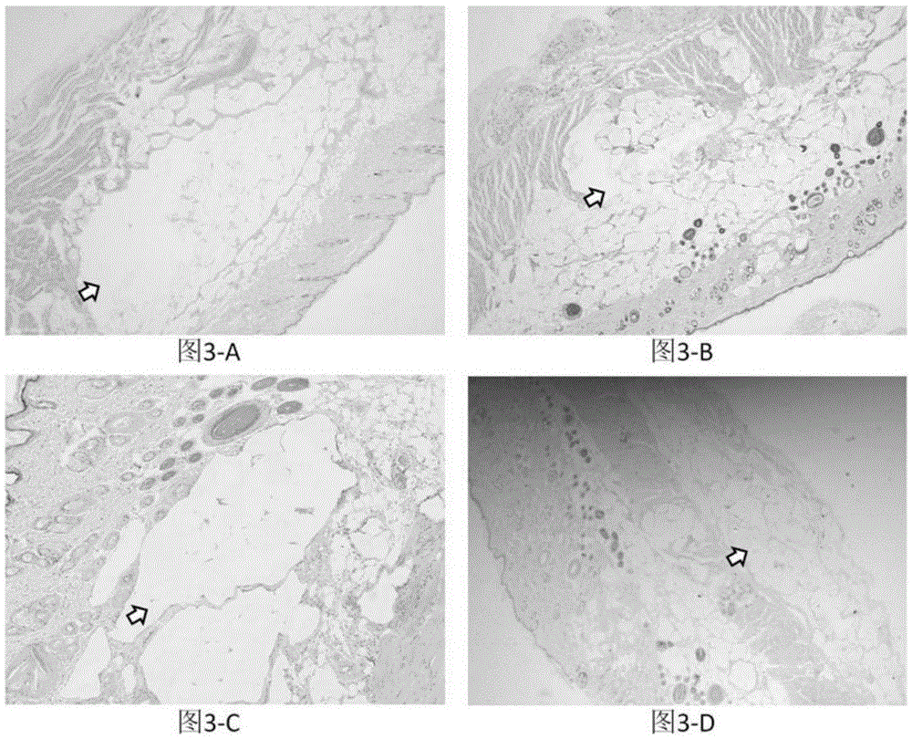 A kind of injectable cross-linked hyaluronic acid gel and preparation method thereof