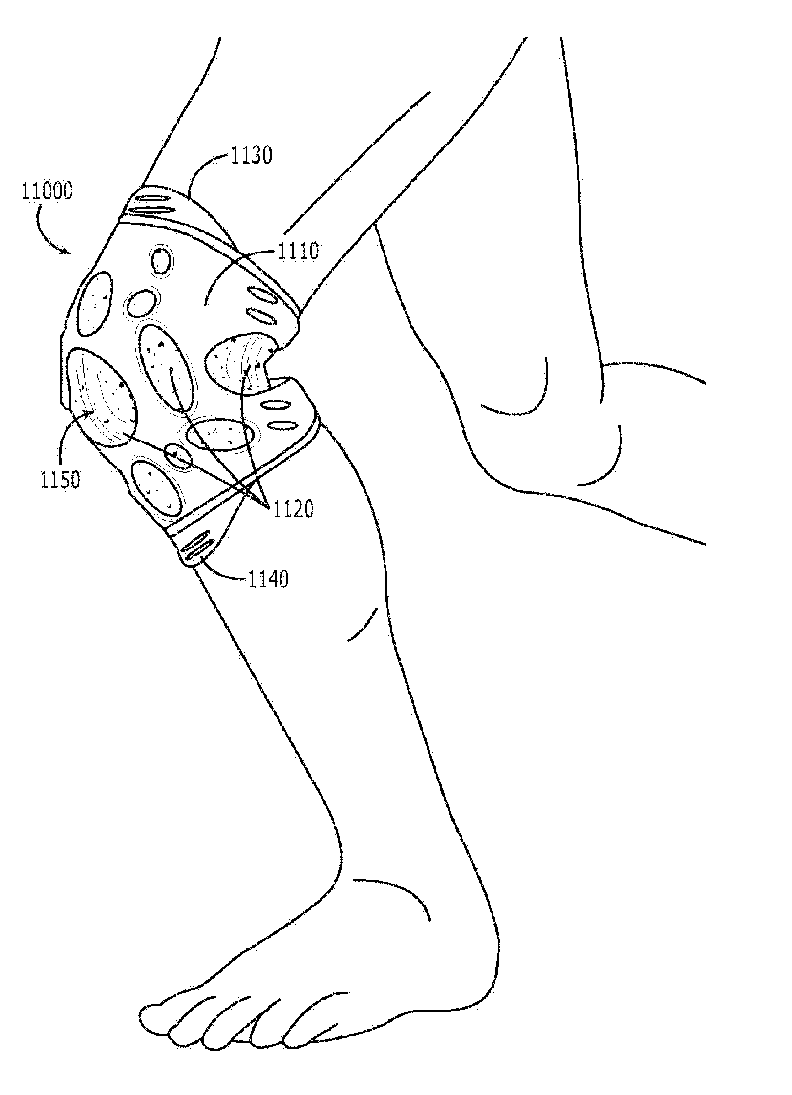 Potentiating support with alignment opening for joint protuberance