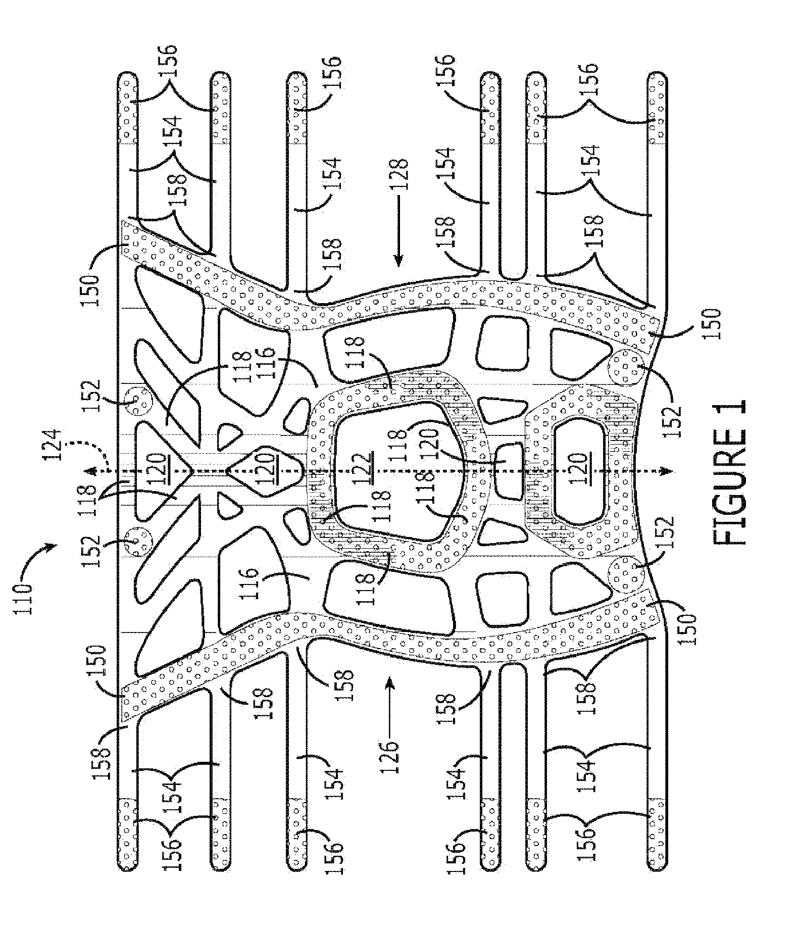 Potentiating support with alignment opening for joint protuberance