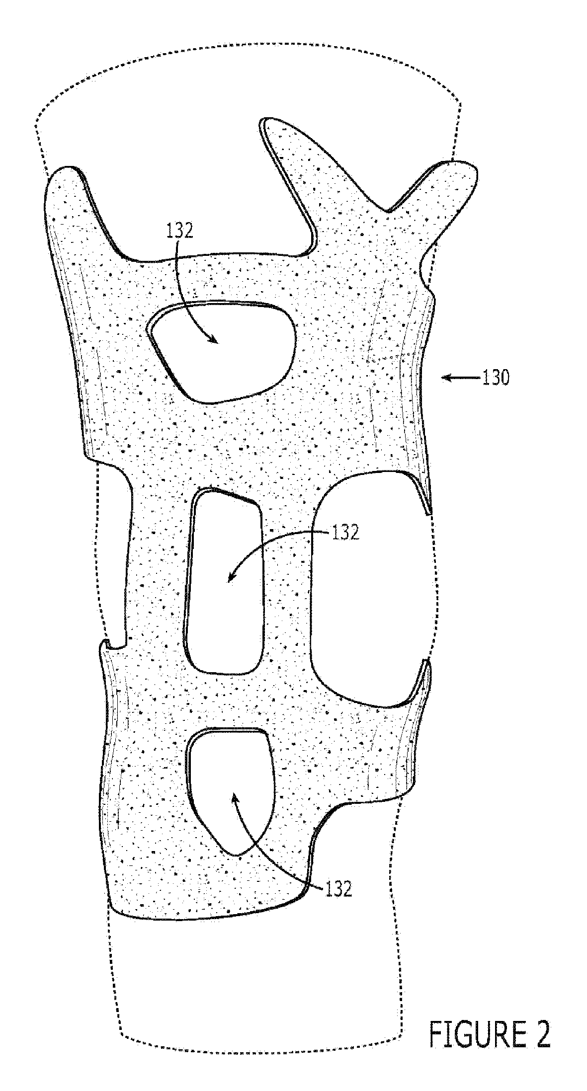 Potentiating support with alignment opening for joint protuberance