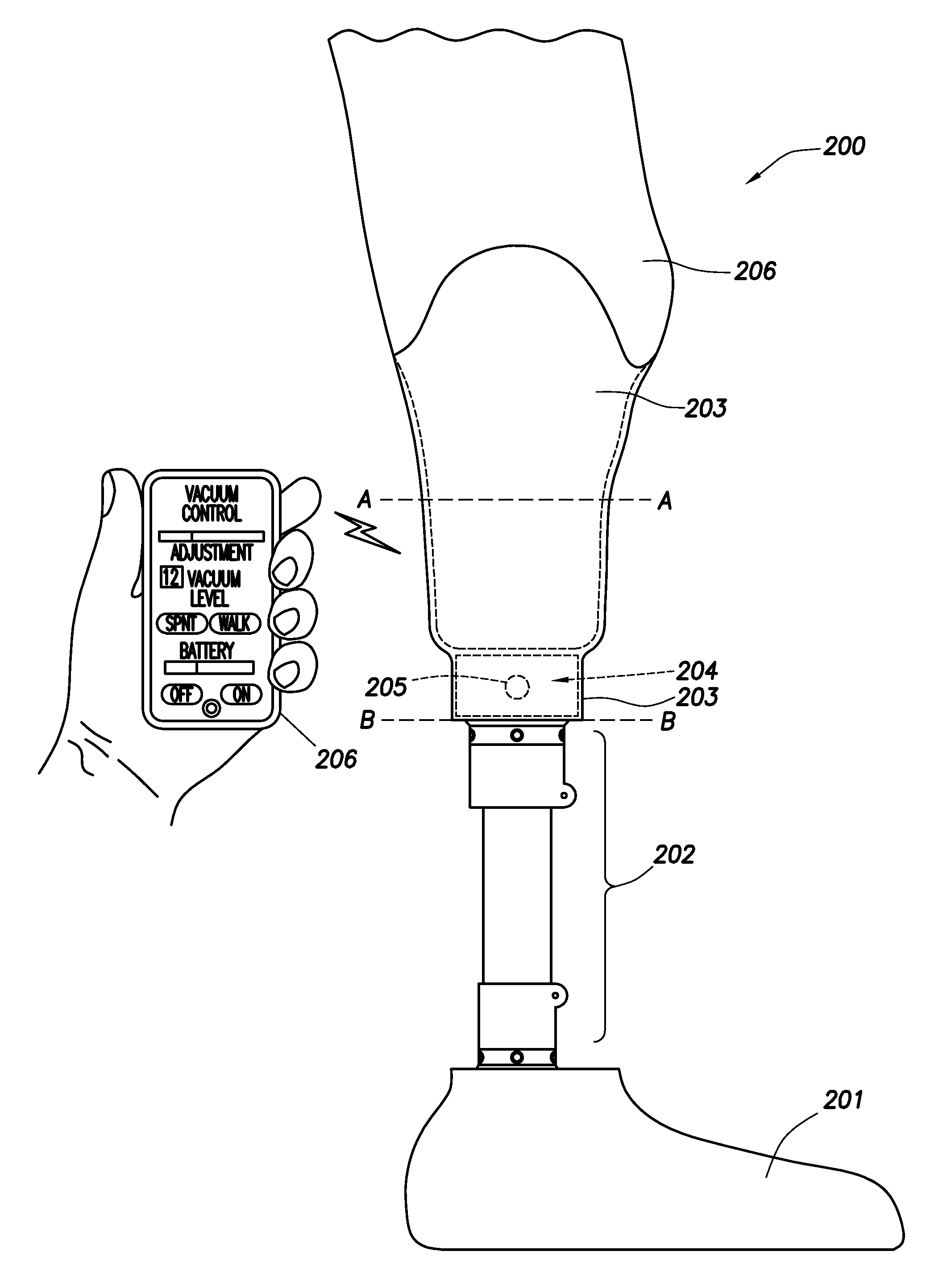 Intelligent prosthetic socket system with active user feedback interface and real time prosthesis diagnostics