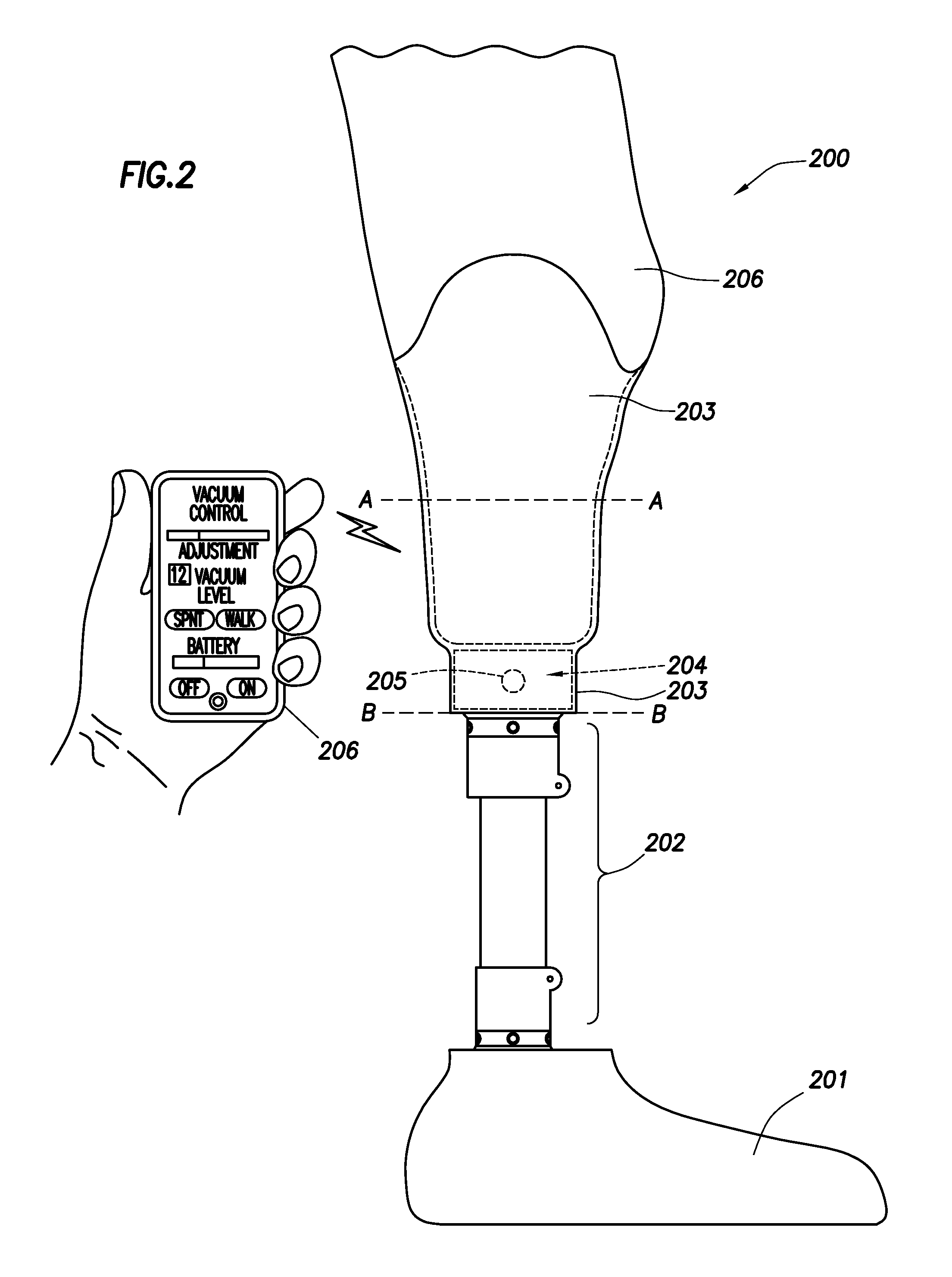 Intelligent prosthetic socket system with active user feedback interface and real time prosthesis diagnostics