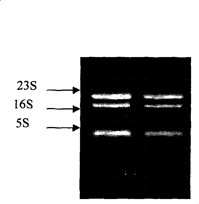 Method for quick extraction of total RNA from radioresistant bacterium