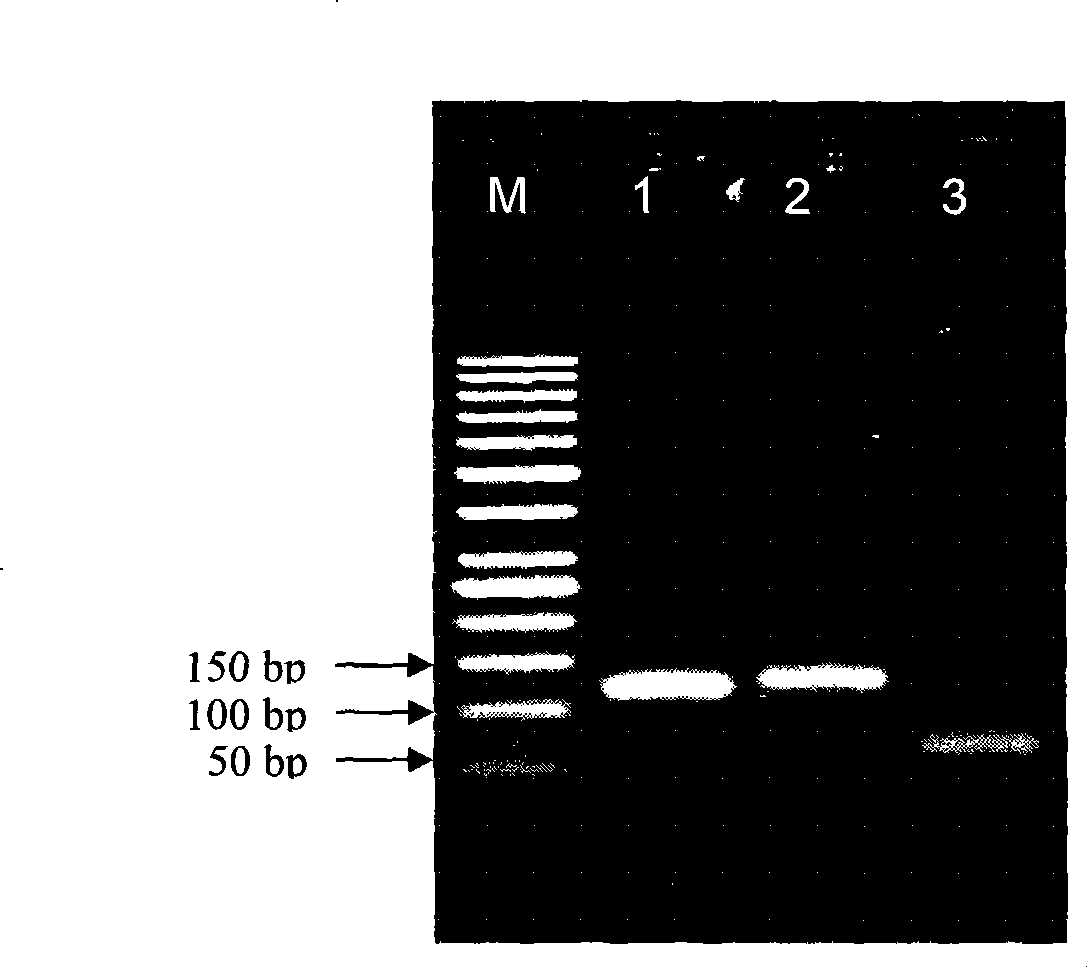 Method for quick extraction of total RNA from radioresistant bacterium