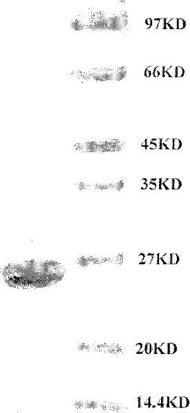 Fusion protein with high-efficient platelet-increasing role and preparation method thereof