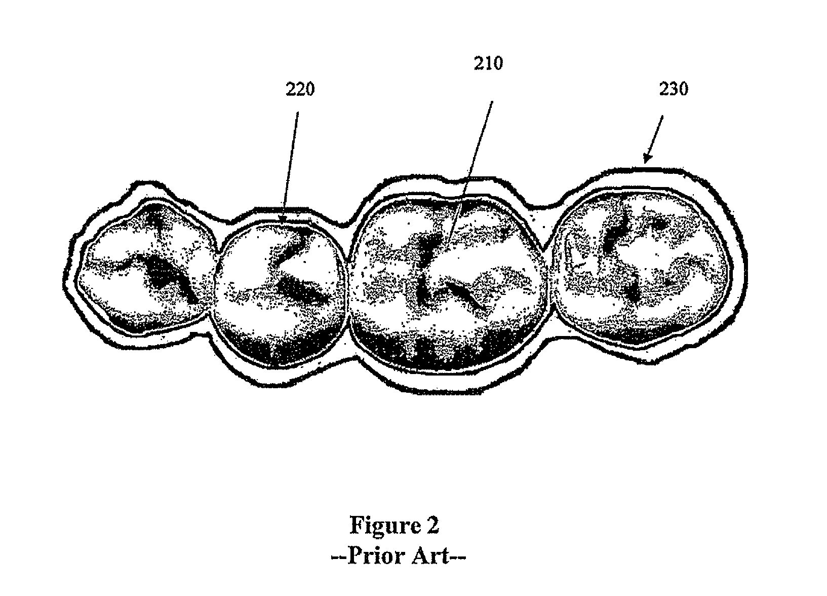 Disposable dental aligner