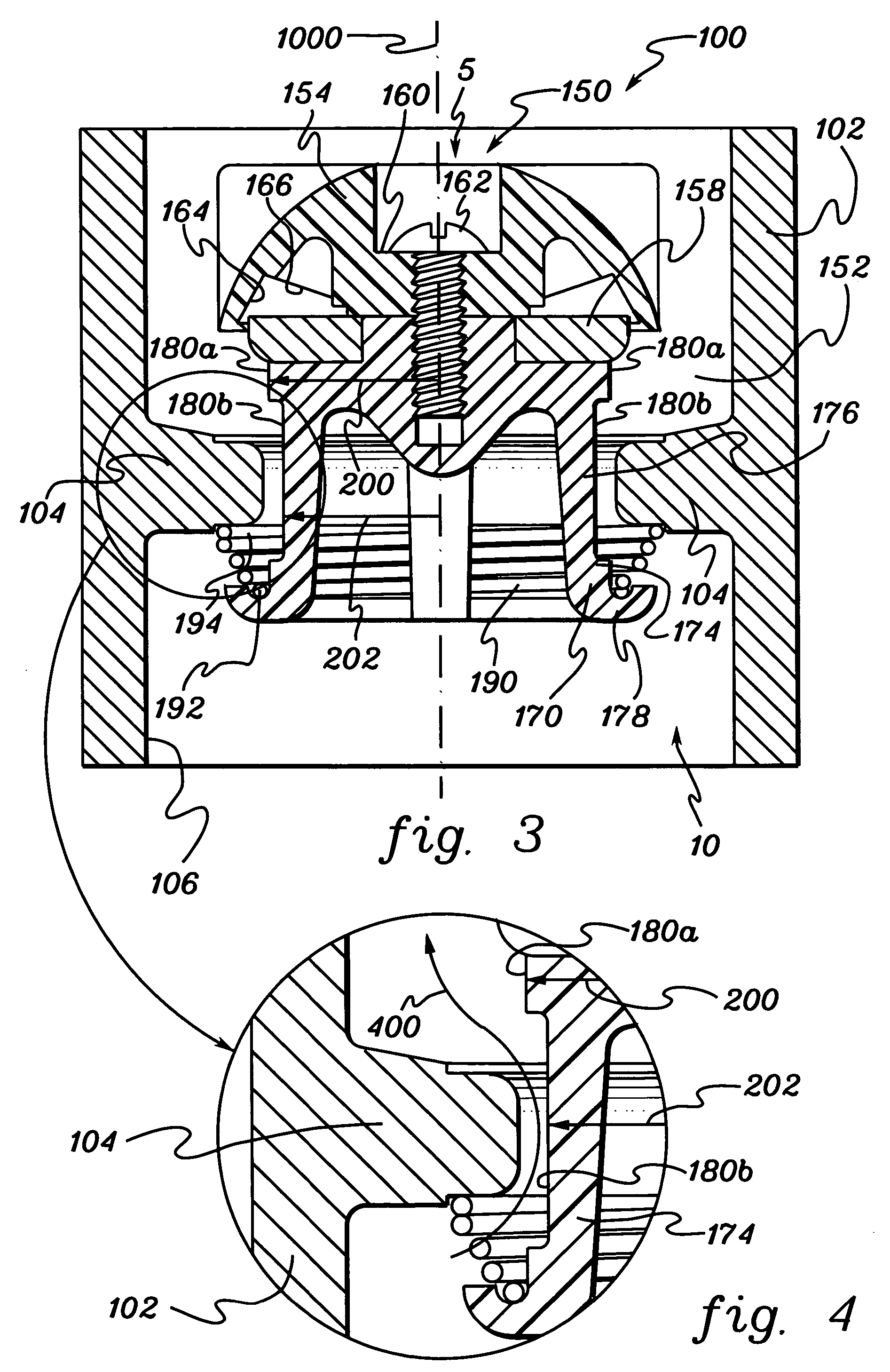 Check valve