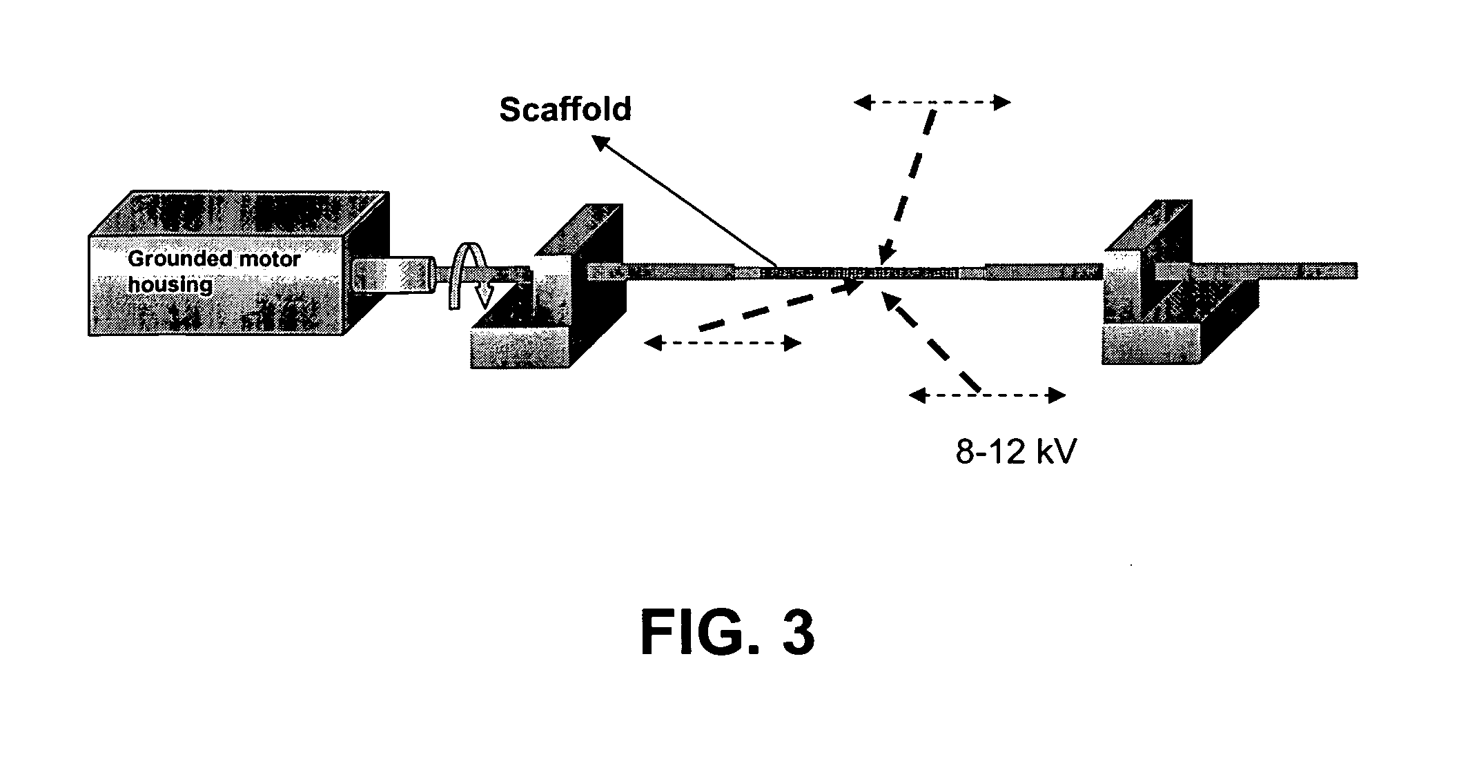 Bio-artificial pancreas and a procedure for preparation of same