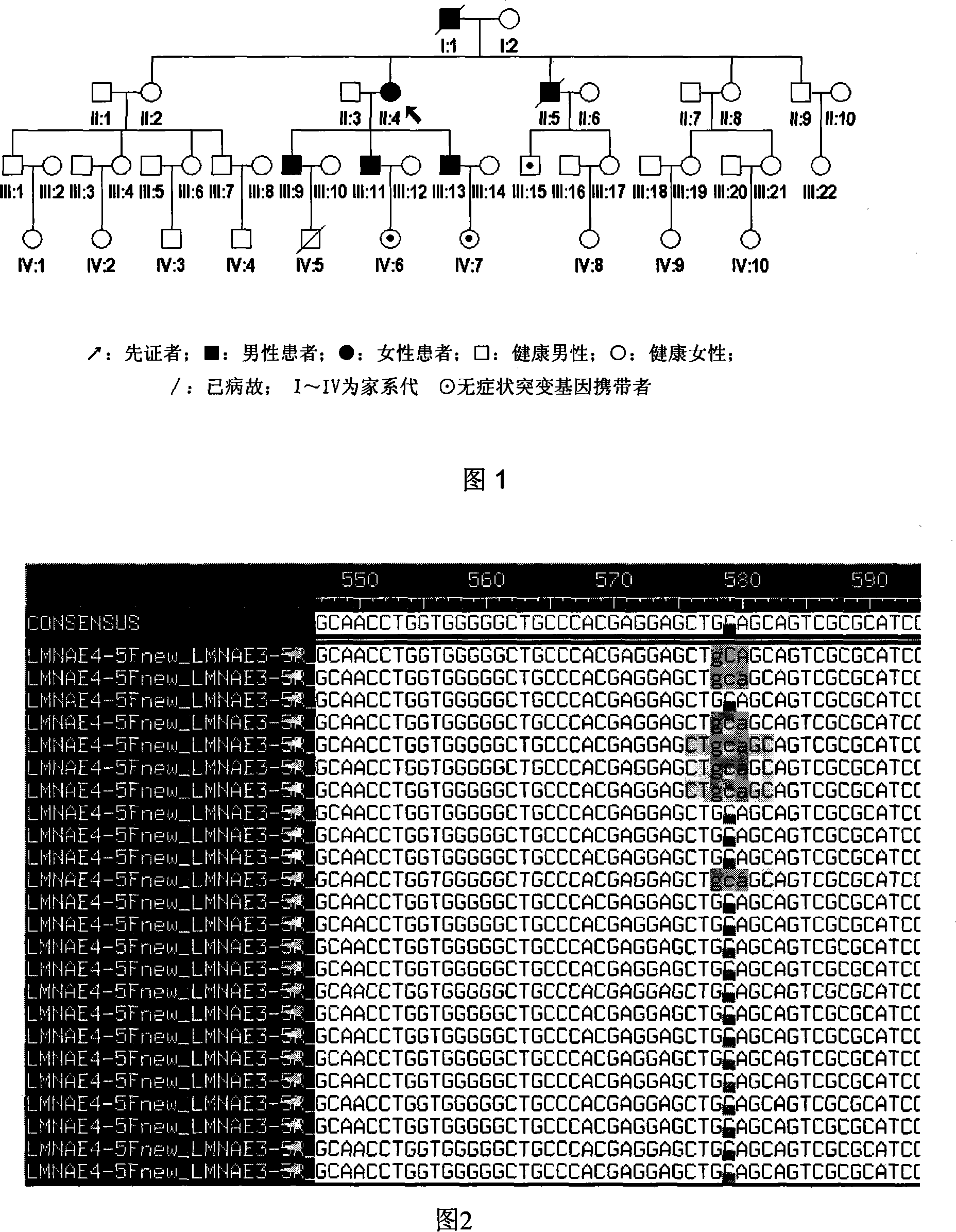 Expanding cardiomyopathy LMNA gene mutation and detecting method thereof