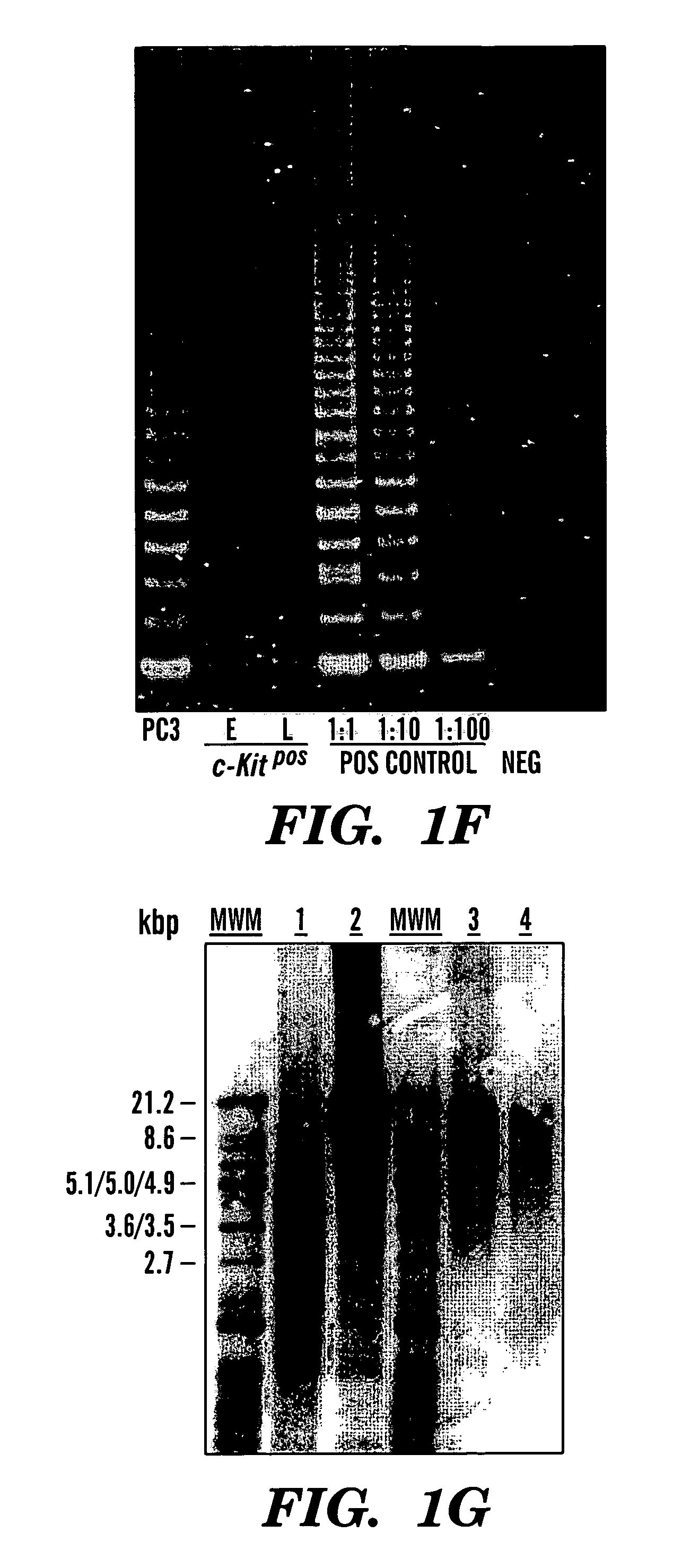 Methods of isolation, expansion and differentiation of fetal stem cells from chorionic villus, amniotic fluid, and placenta and therapeutic uses thereof