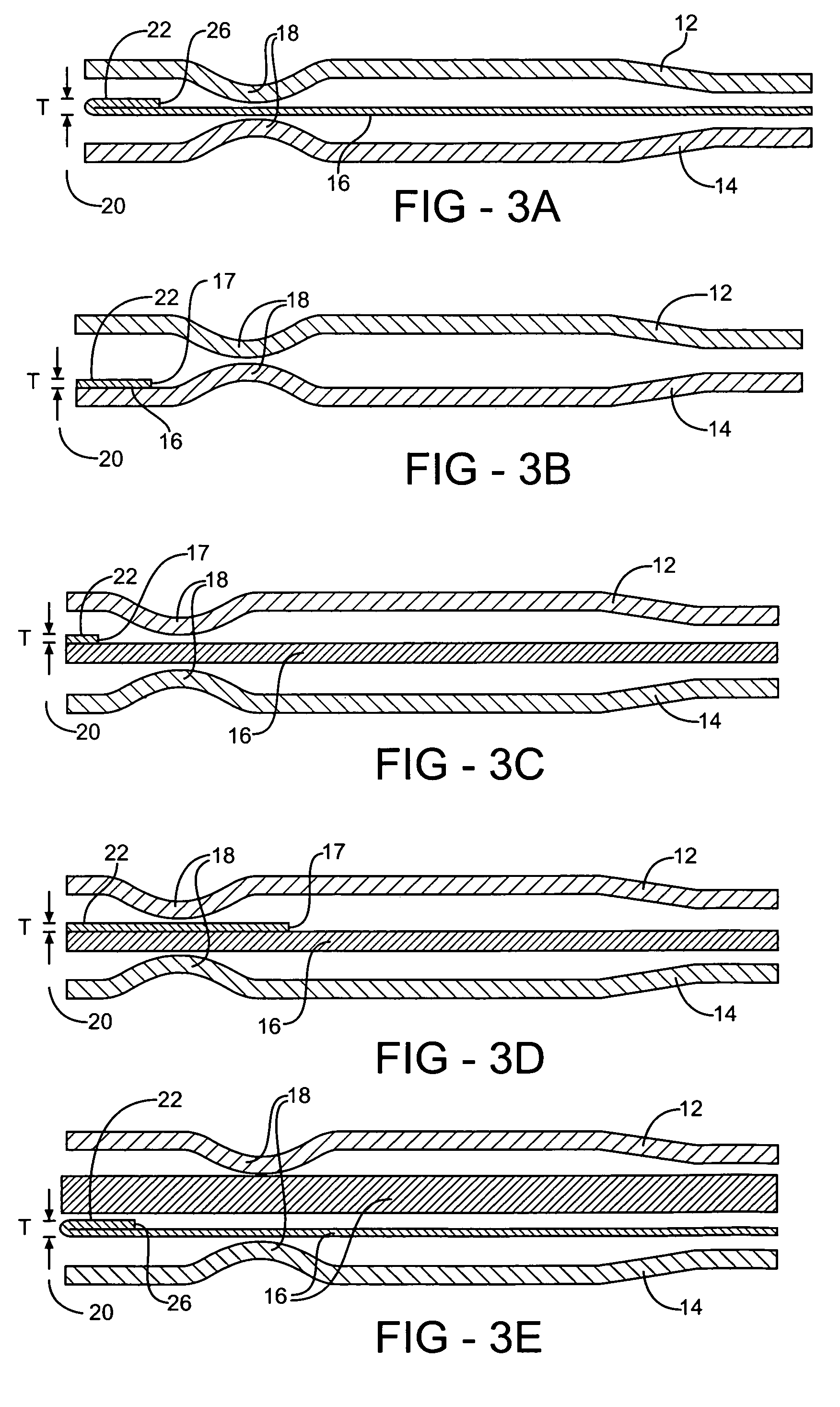 Enhanced multilayer metal gasket