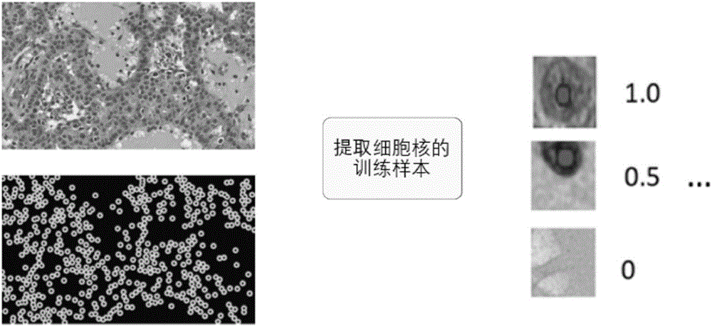 Method for analyzing histopathologic image and system thereof