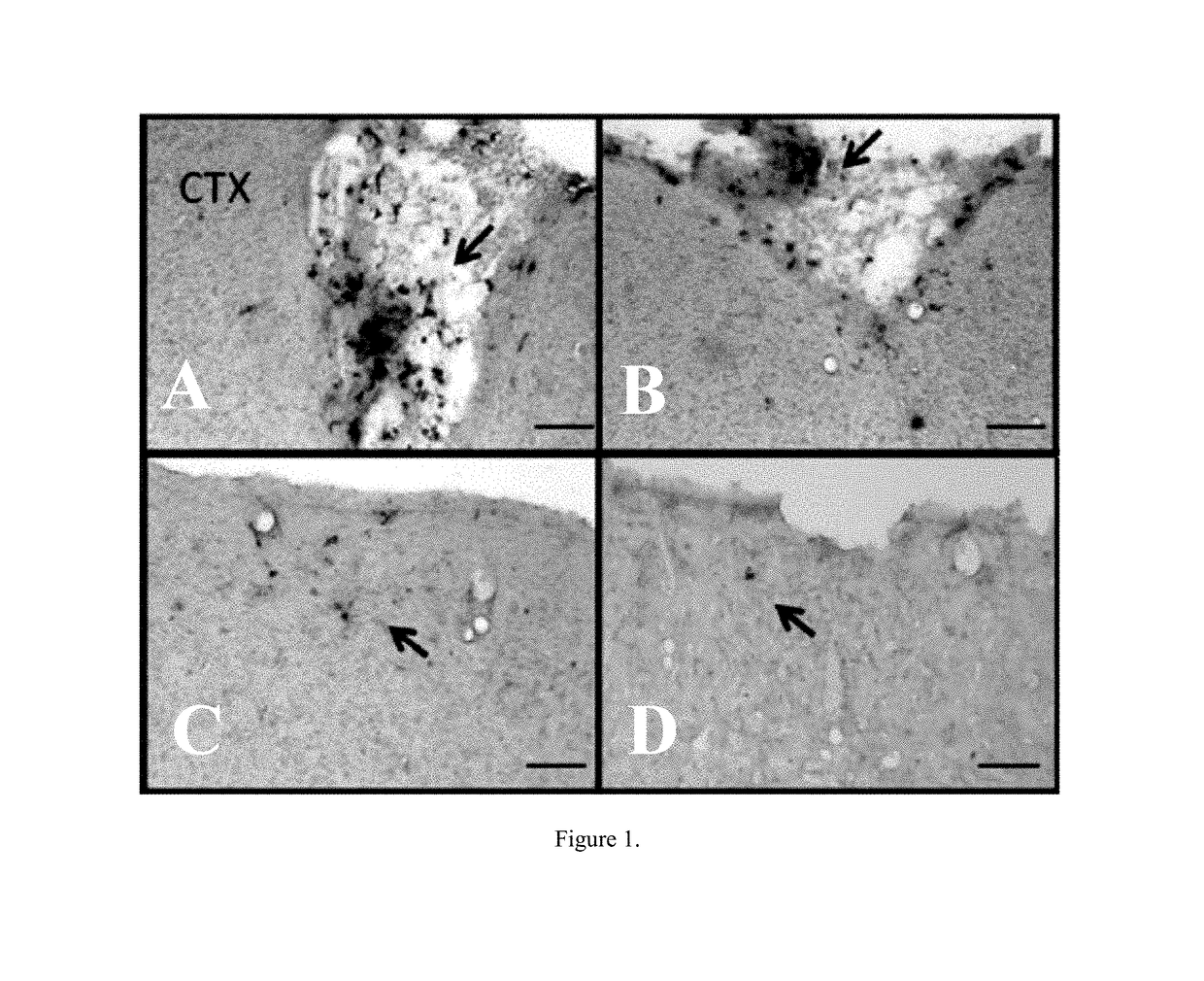 Combination therapy of stem cell mobilizing agents and stem cell transplantation