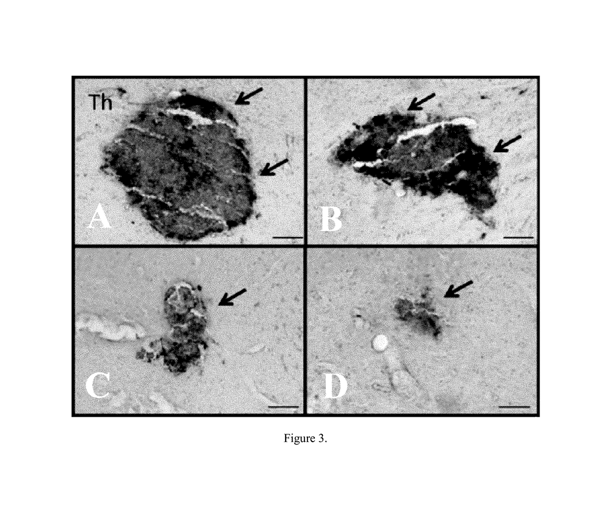 Combination therapy of stem cell mobilizing agents and stem cell transplantation