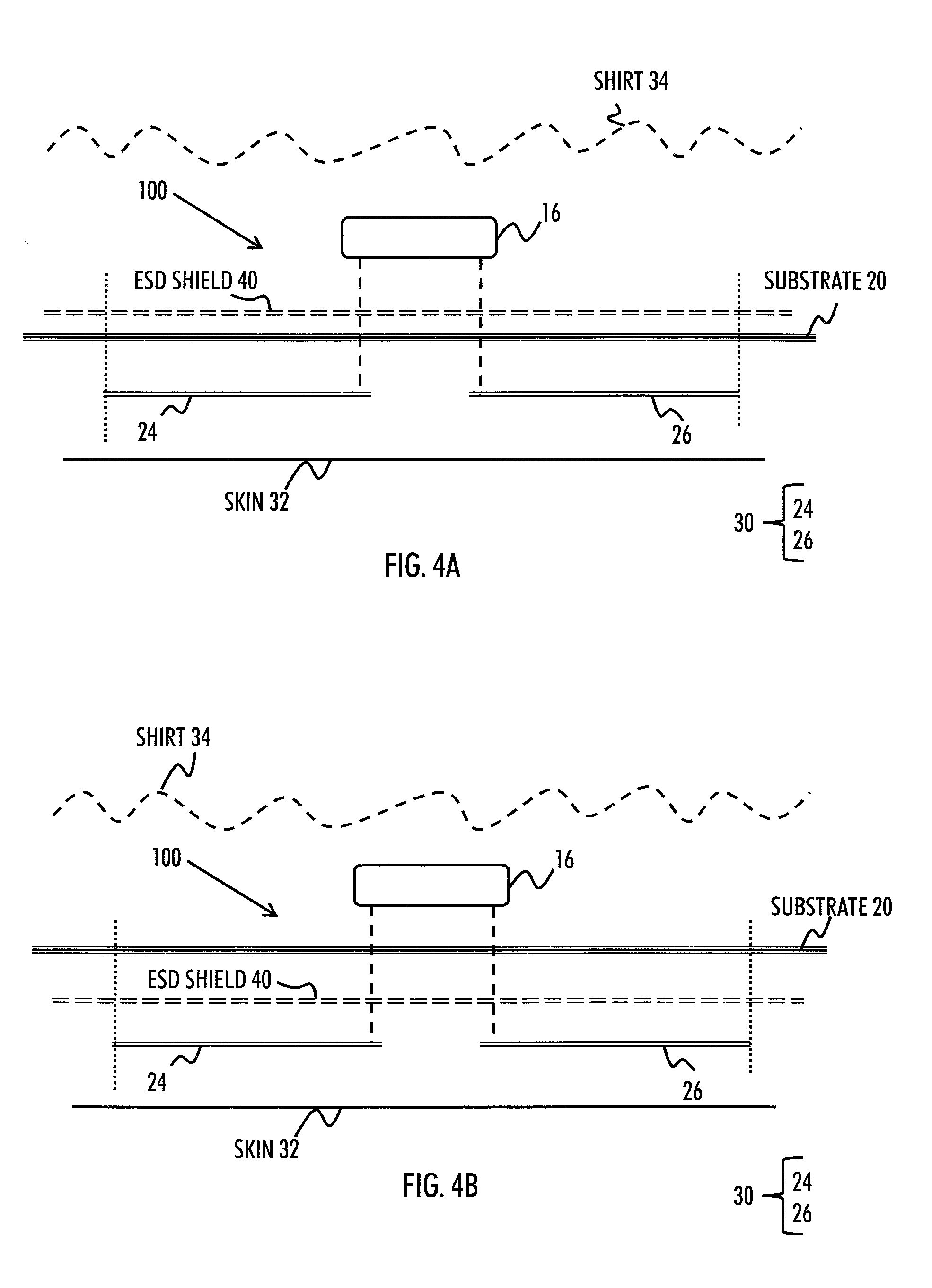 Heart activity sensor structure