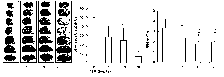 Application of neostigmine hyoscyamine in preparation of medicine for treating acute cerebral ischemic injury