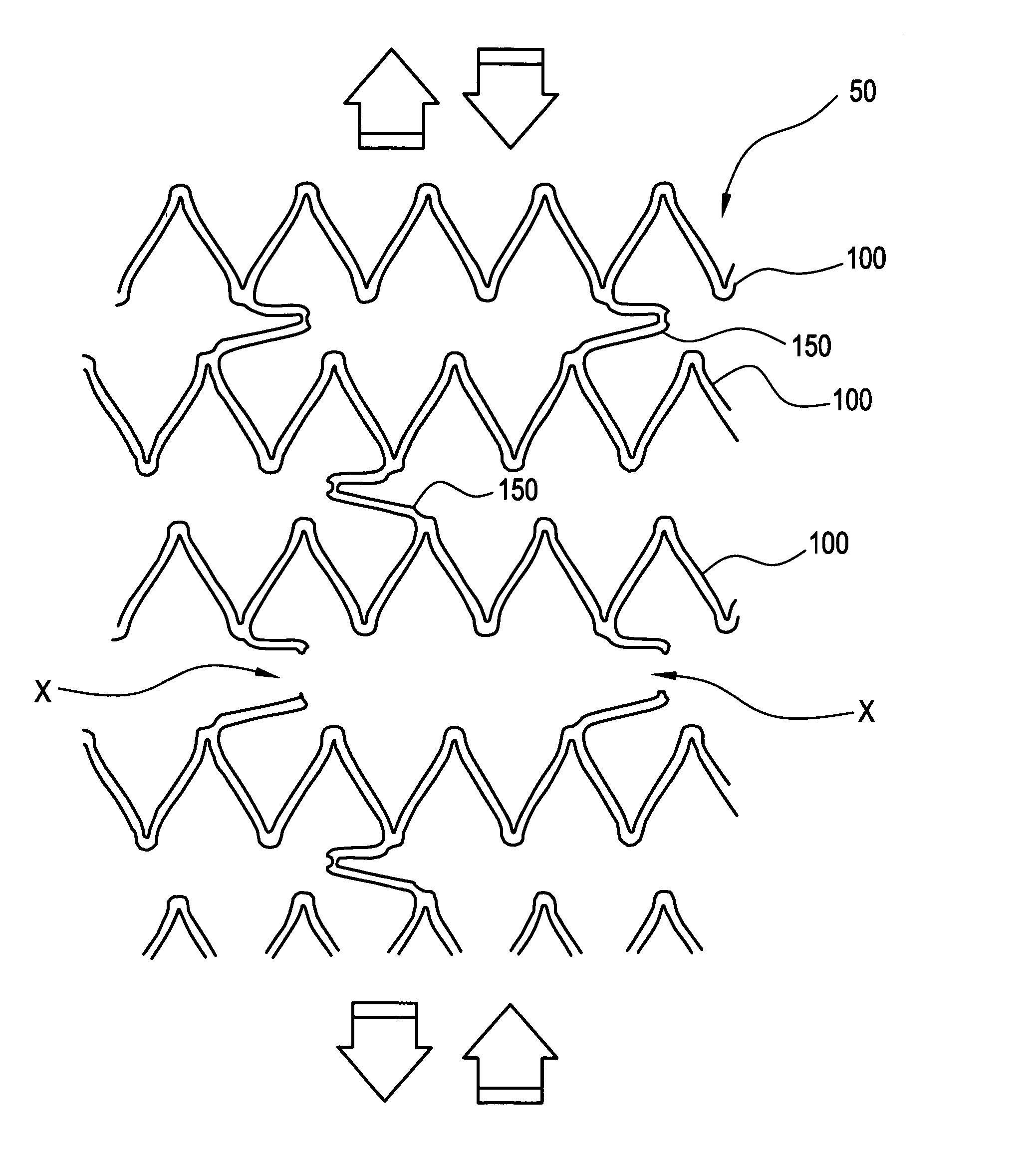 Intraluminal medical device with strain concentrating bridge