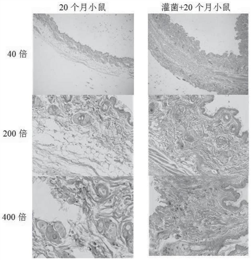 Lactobacillus plantarum, microbial agent and application thereof