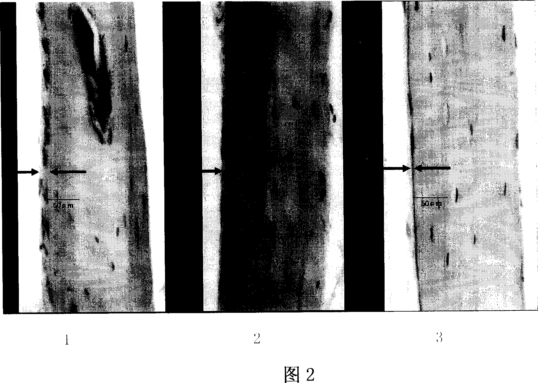 Application of Dendrobium nobile in the preparing process of bone disease treating medicine