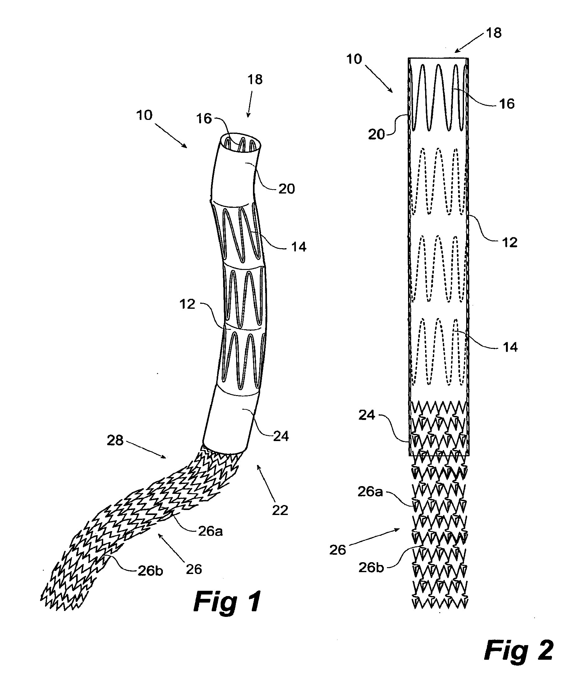 Iliac leg extension stent graft