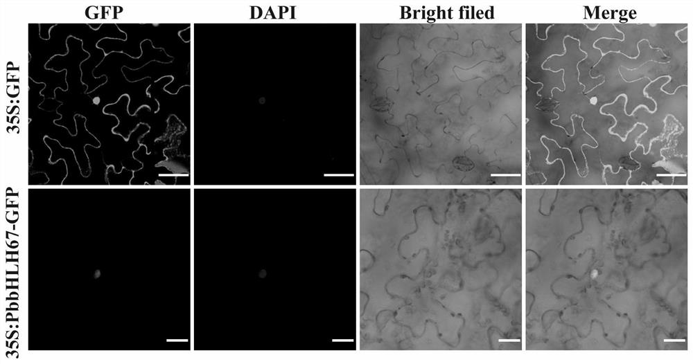 Pyrus betulaefolia salt-tolerant gene, protein, recombinant vector and application